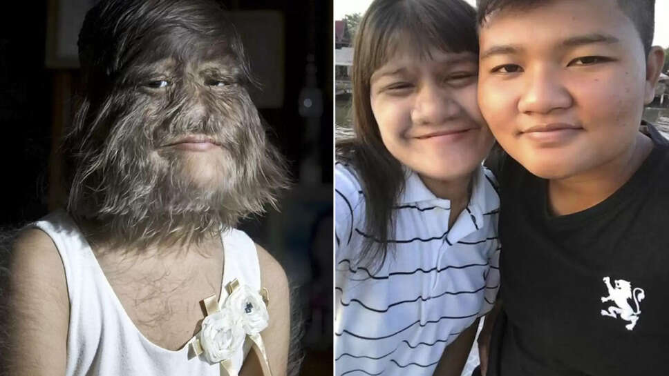 When The World's Hairiest Women Shaved Her Face After Finding Love