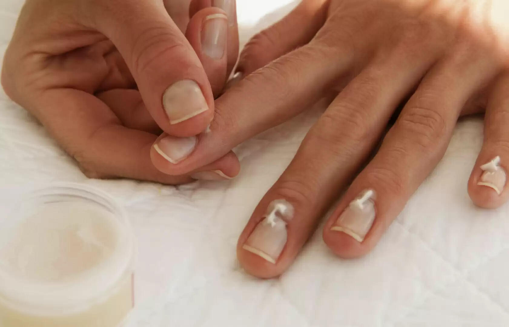 Nail Care after Remove Nail Polish