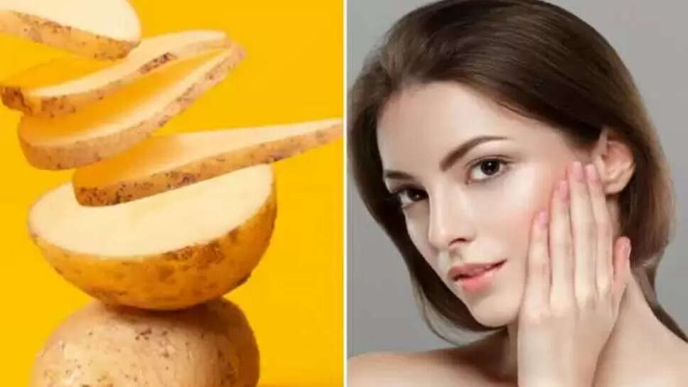 Potato Face Packs