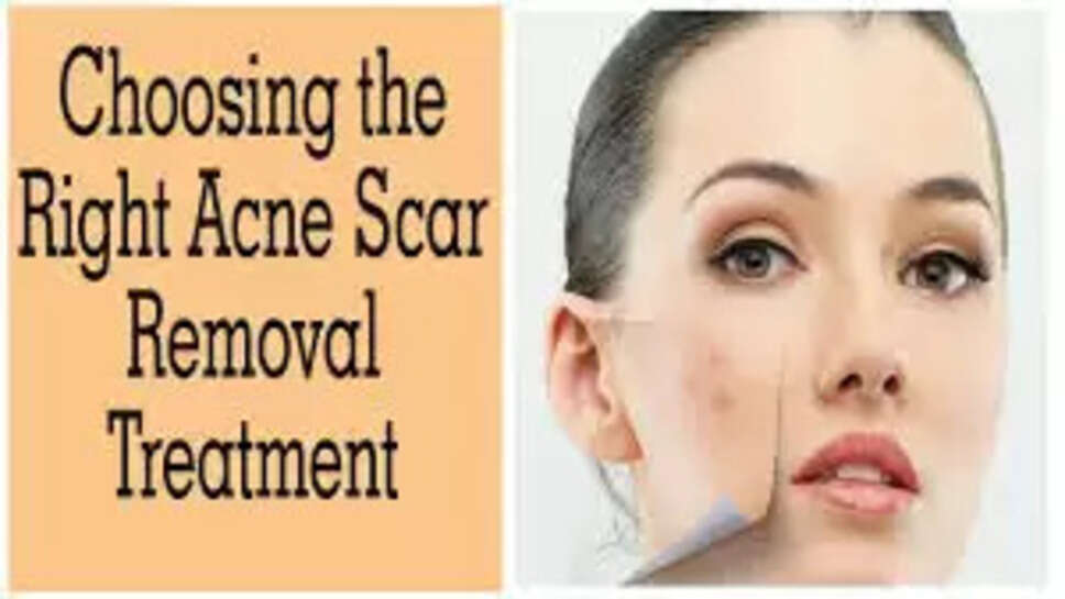 What Are The Risks and Side Effects of Face Scar Treatments